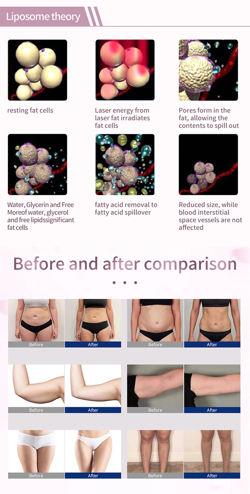 Máquina láser Profesional Para reducción De Grasa, Equipo De Belleza Anticelulitis, Adelgazante, pérdida De Peso Corporal, 14 Al